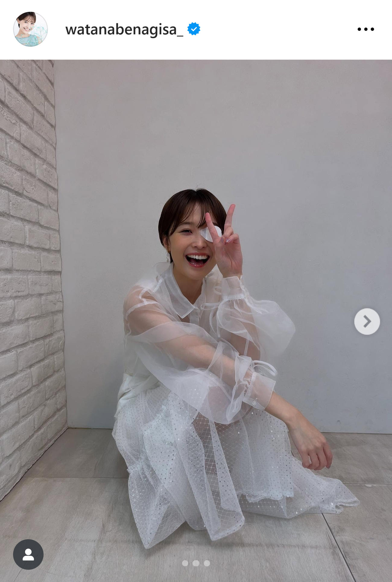 スケスケ衣装で眼帯ピース（渡邊渚のインスタグラムから）