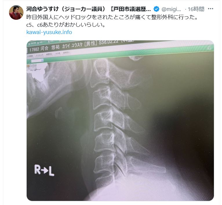 河合ゆうすけ氏のＸから