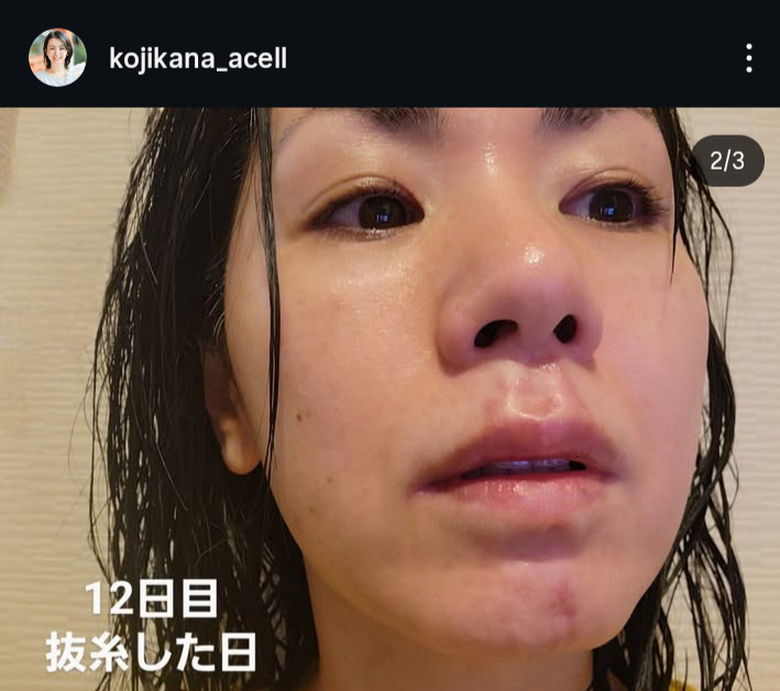 小島可奈子のインスタグラムから
