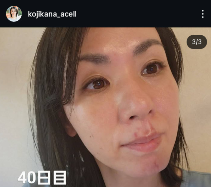 小島可奈子のインスタグラムから