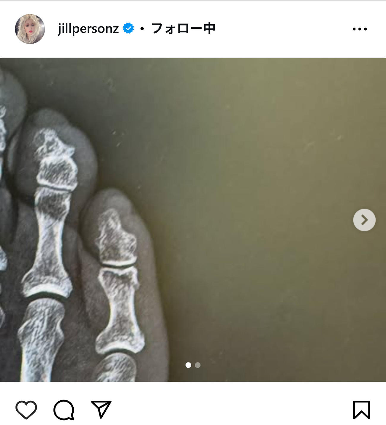PERSONZのJILLのインスタグラムから　