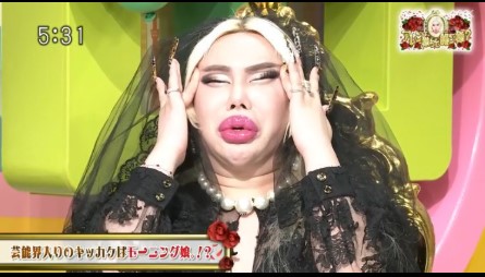 アレンのXから