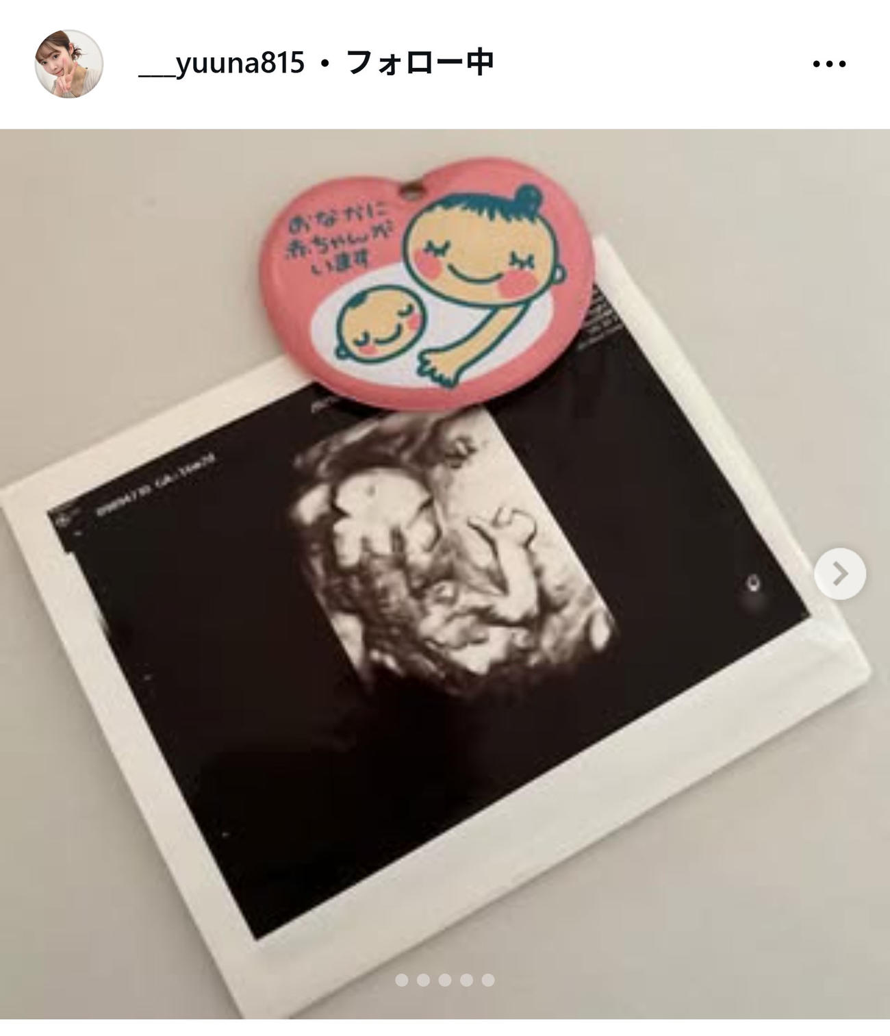 伊藤祐奈さんのインスタグラムから
