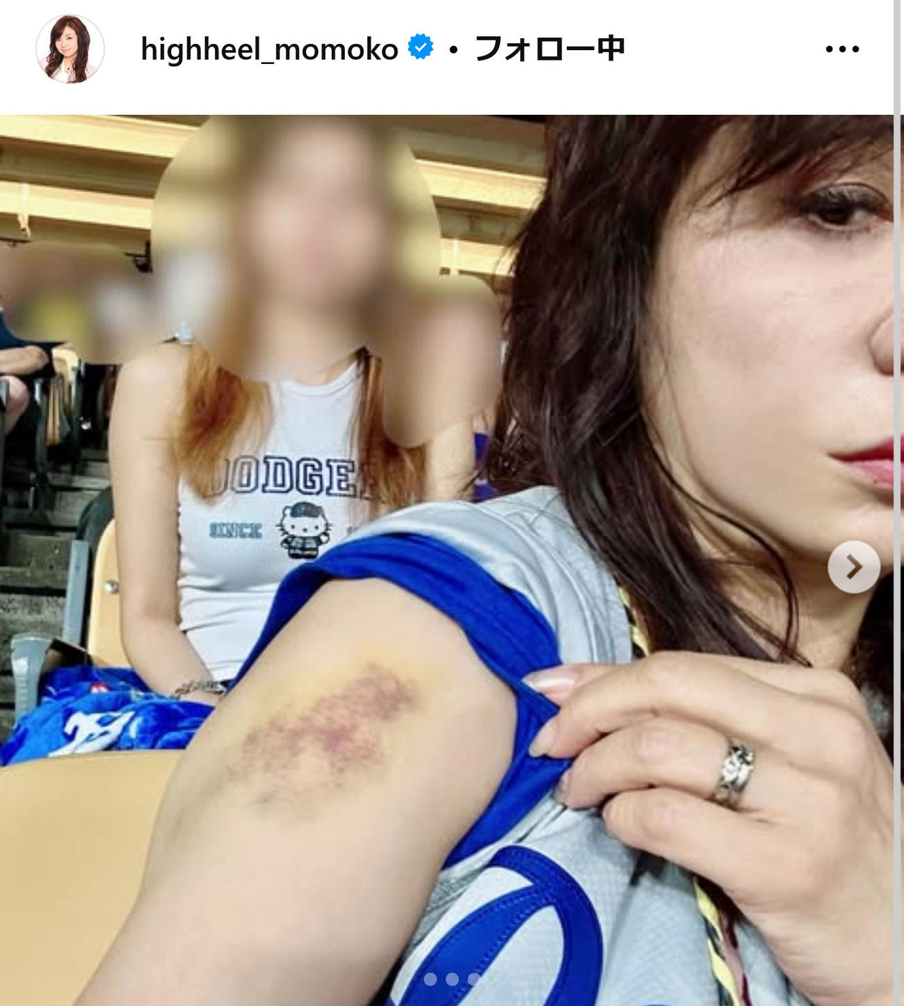 ハイヒール・モモコのインスタグラムから