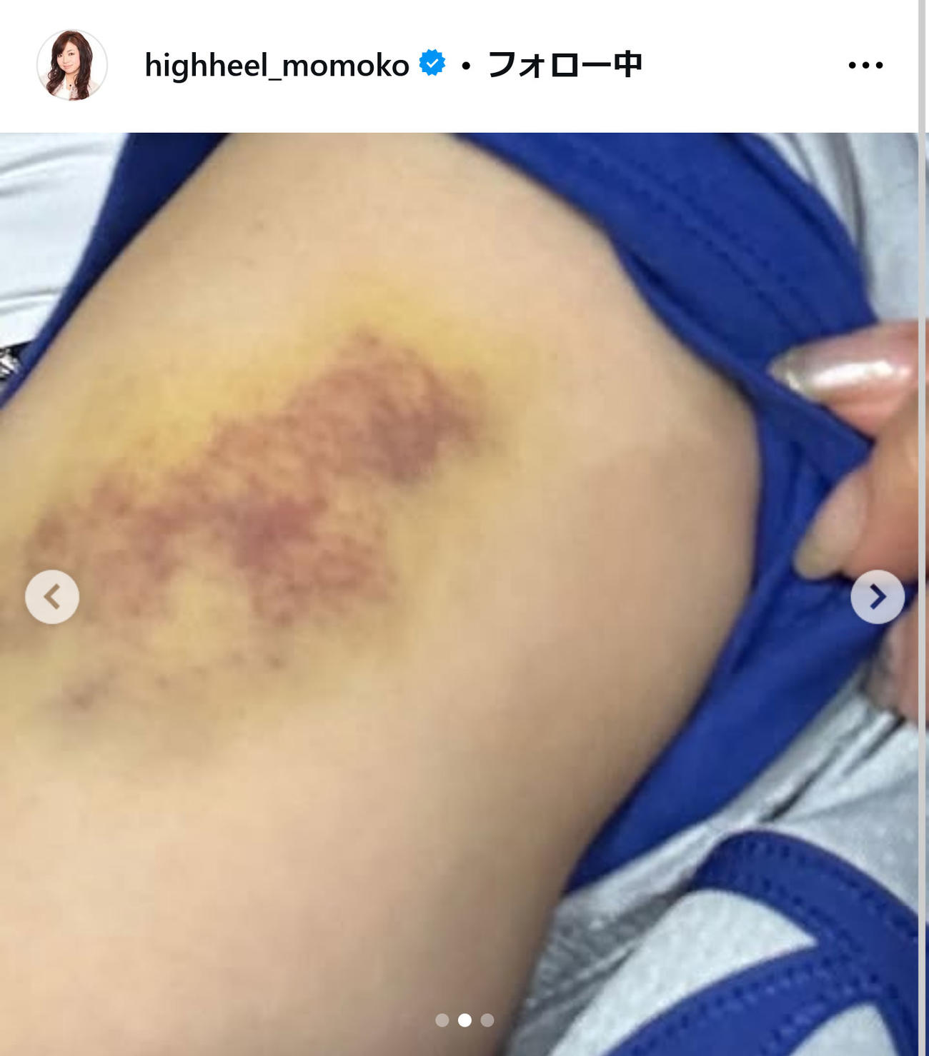 ハイヒール・モモコのインスタグラムから