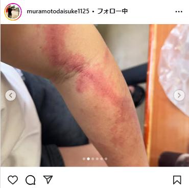 村本大輔のインスタグラムから