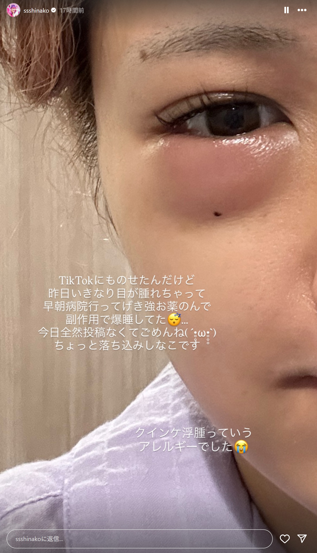 しなこのストーリーズから