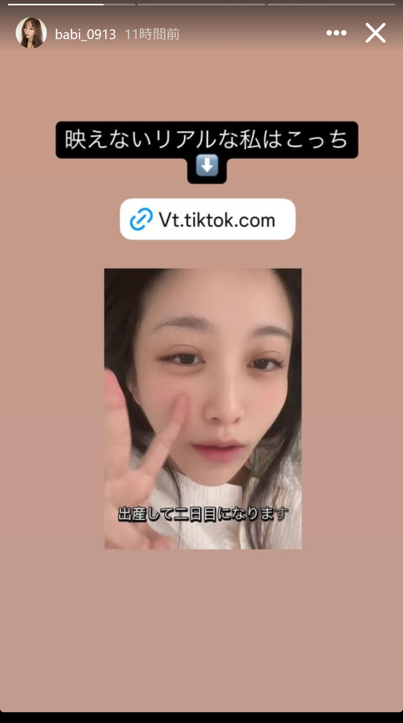 BABIのインスタグラムから