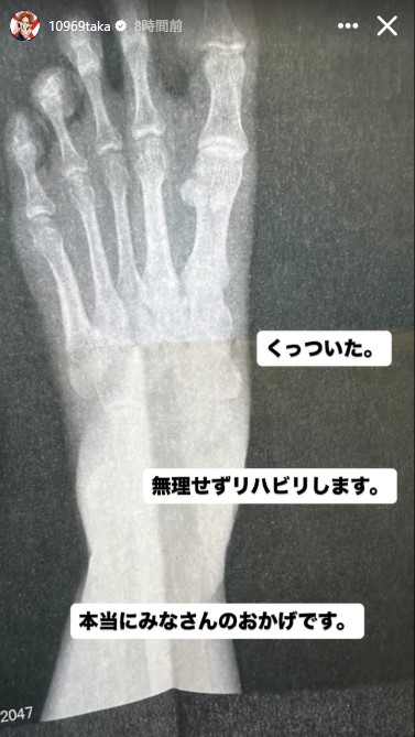 ONE OK ROCKのボーカルTakanのインスタグラムから