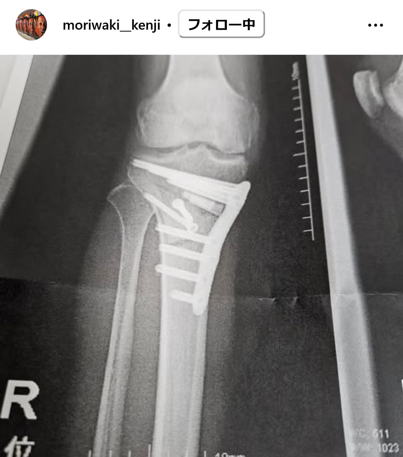 森脇健児のインスタグラムから