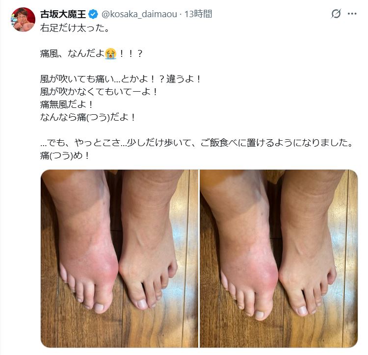 古坂大魔王のXから