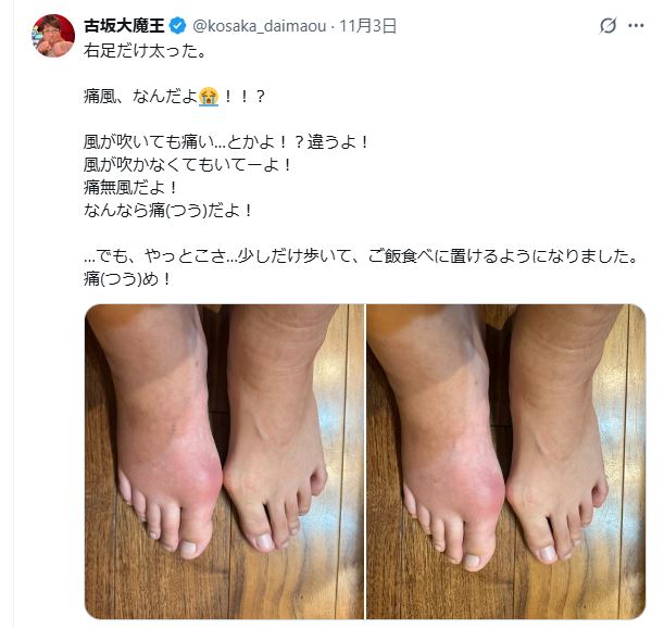 古坂大魔王のXから