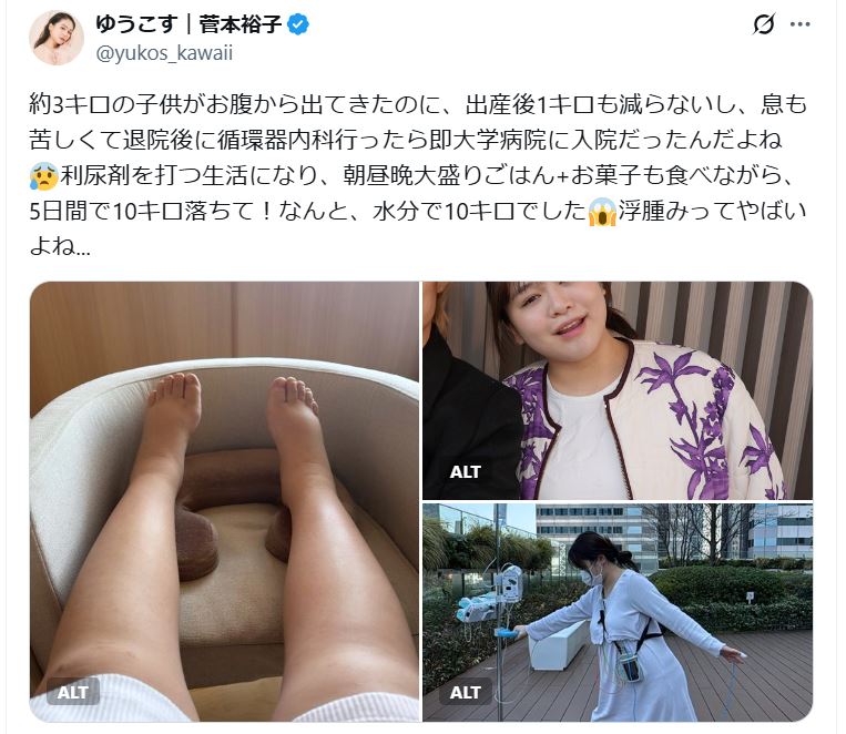 「ゆうこす」こと菅本裕子さんのXから