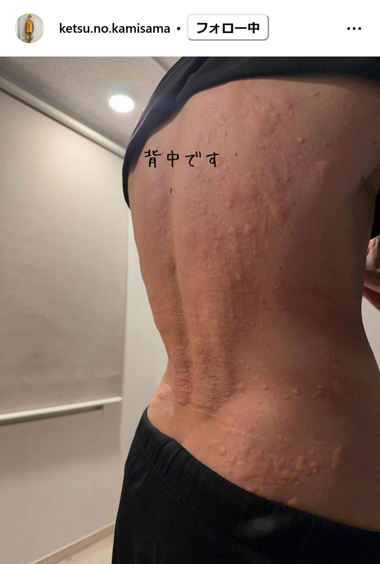 ゴールデンボンバー樽美酒研二のインスタグラムから
