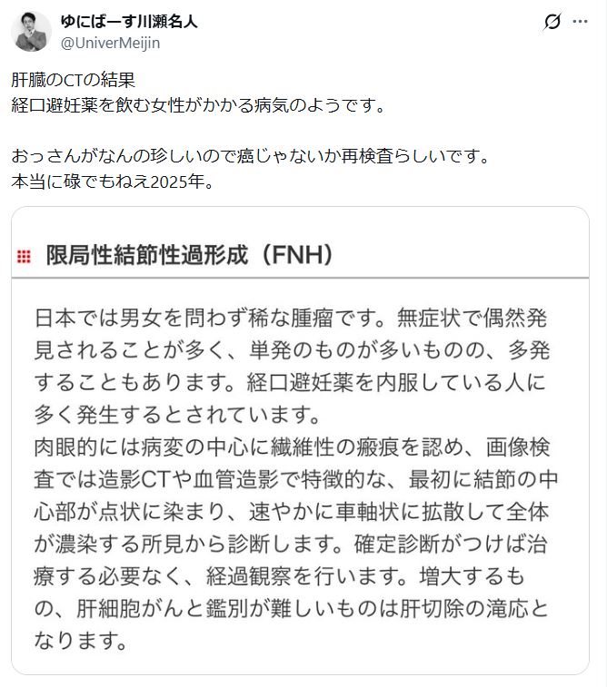 ゆにばーす川瀬名人のXから