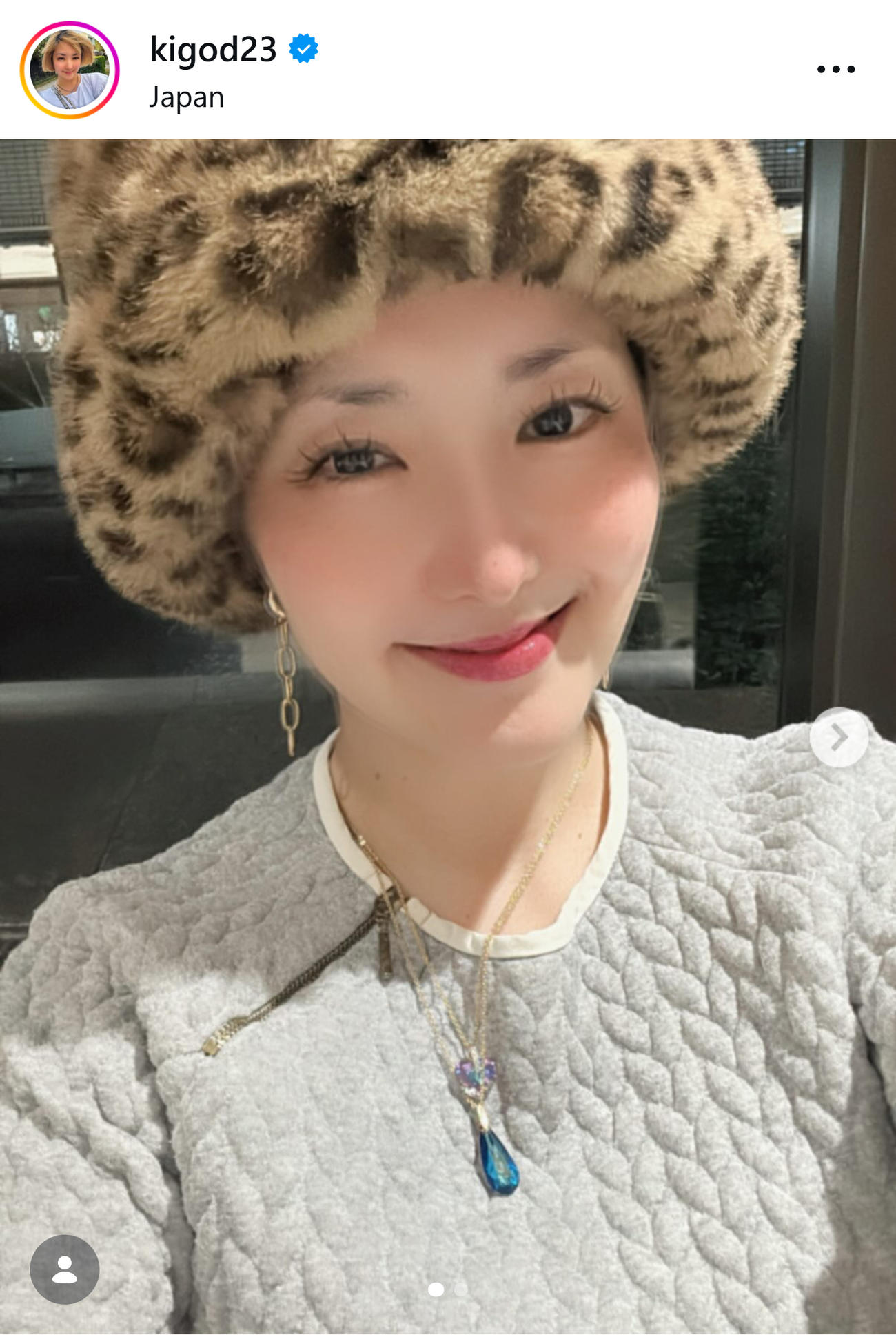 CT検査の結果を報告した希良梨さん（希良梨さんのインスタグラムから）
