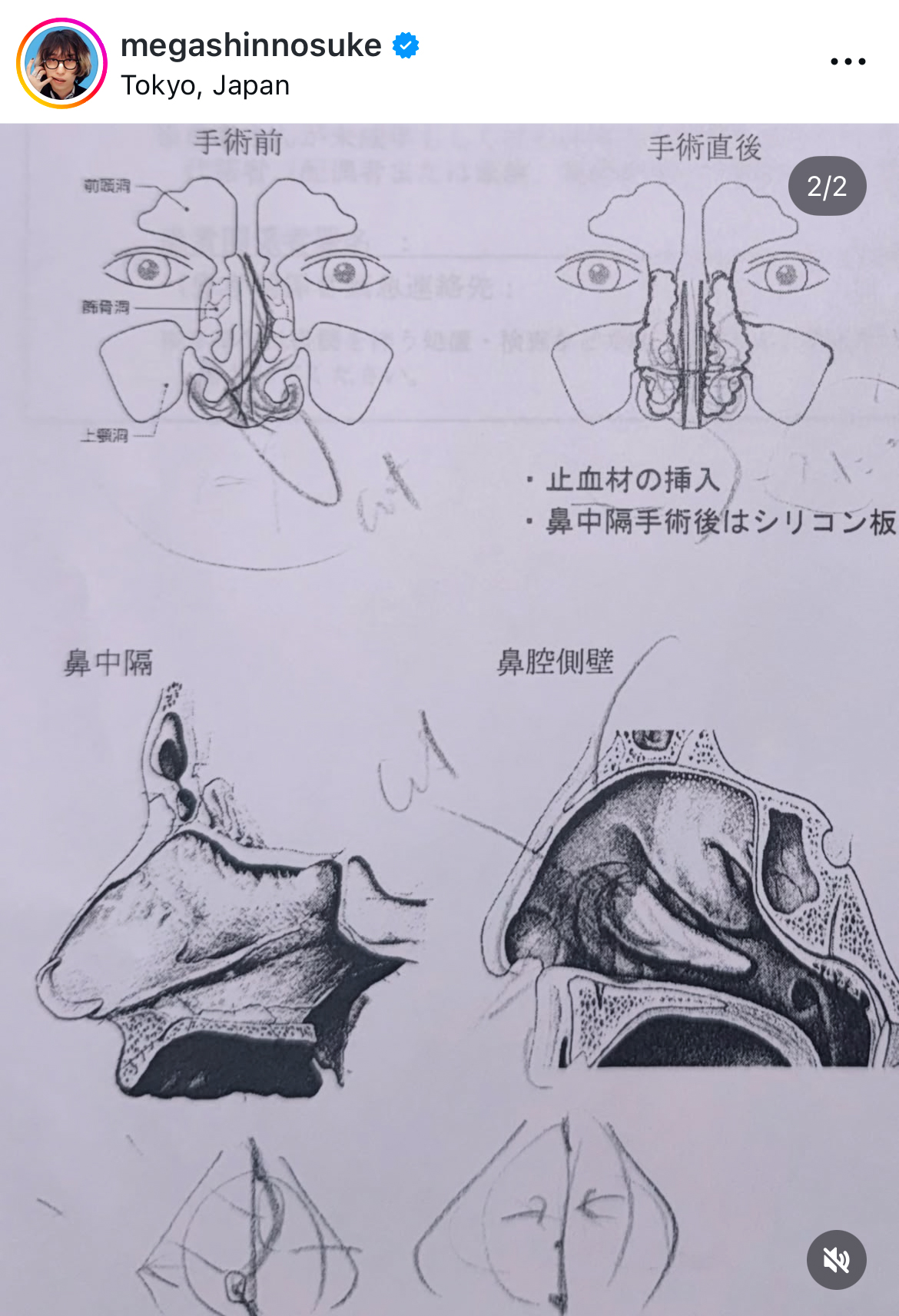 Mega Shinnosukeのインスタグラムから