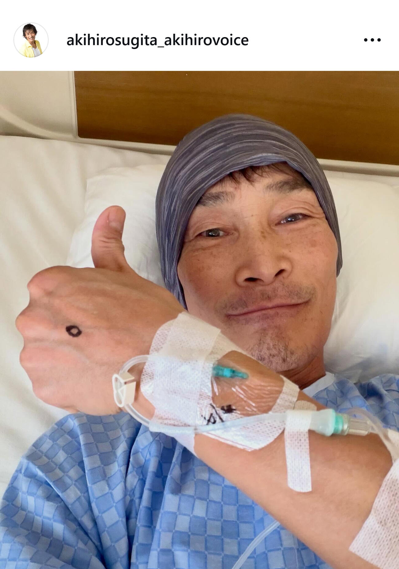 放射線性顎骨壊死の手術を終えたことを報告した杉田あきひろ（杉田あきひろのインスタグラムから）