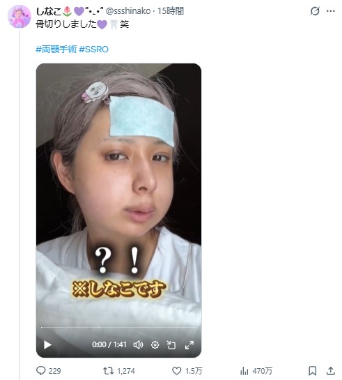 しなこのXから