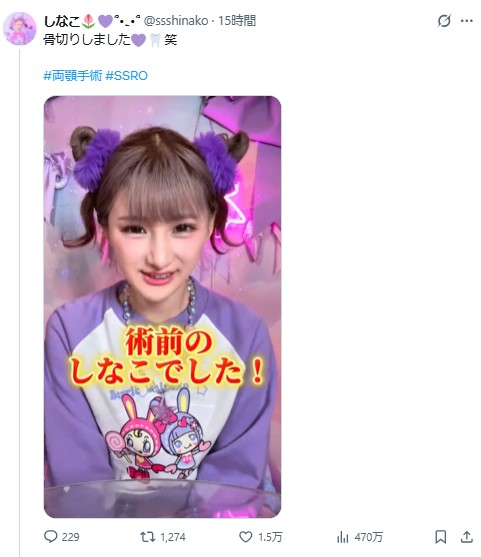 しなこのXから