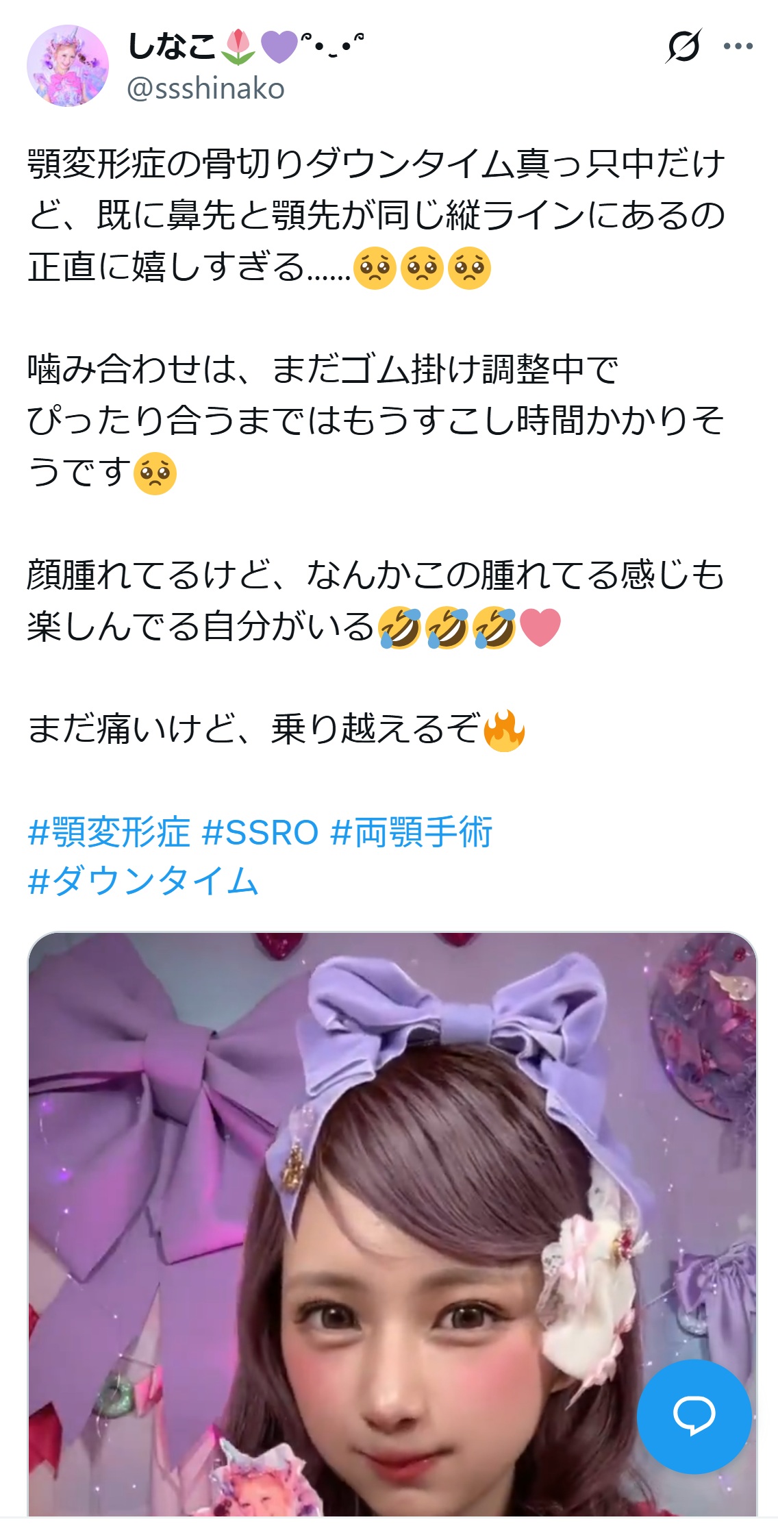 しなこのXから