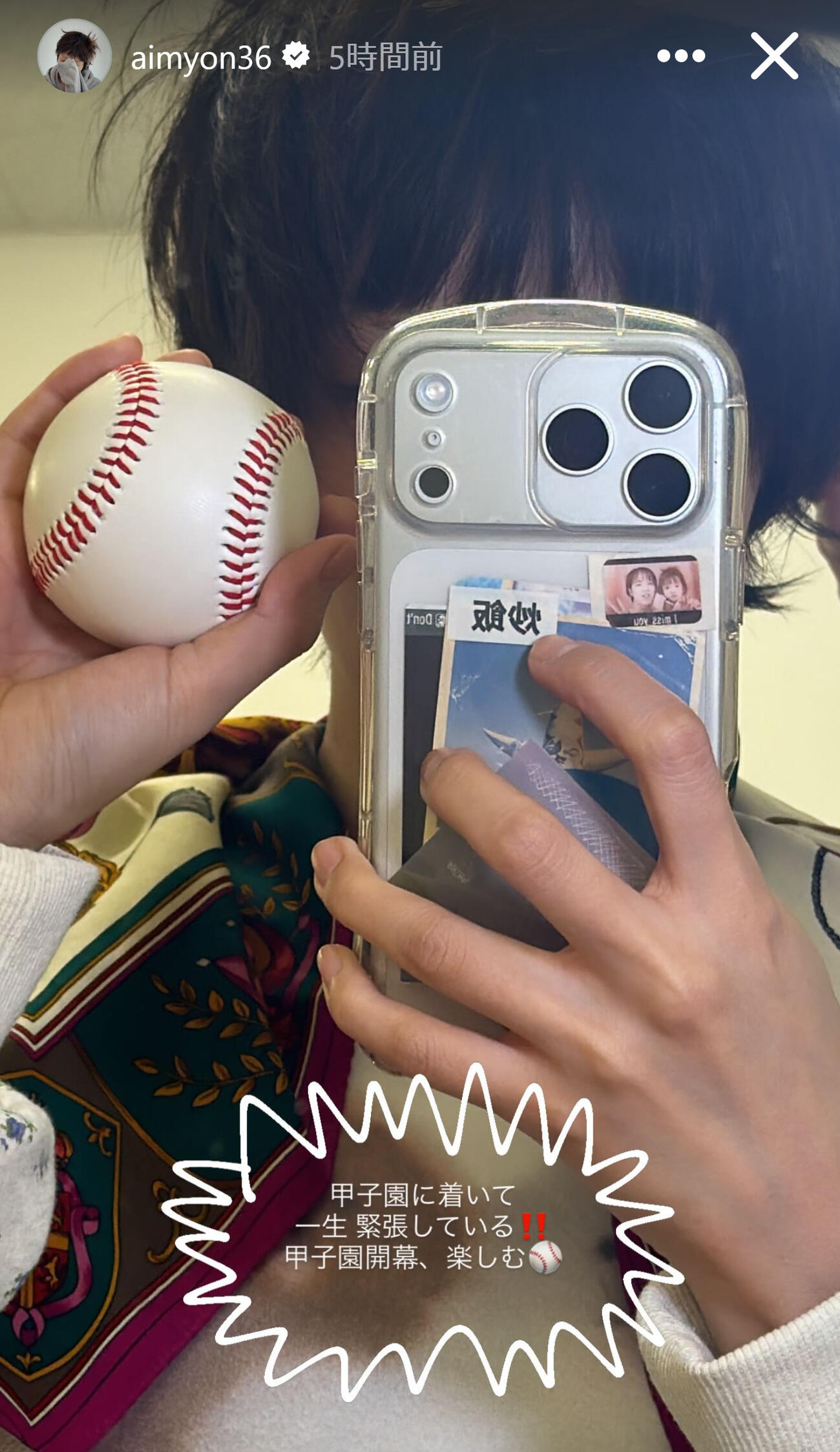 甲子園での始球式を控え緊張するあいみょん（あいみょんのインスタグラムから）