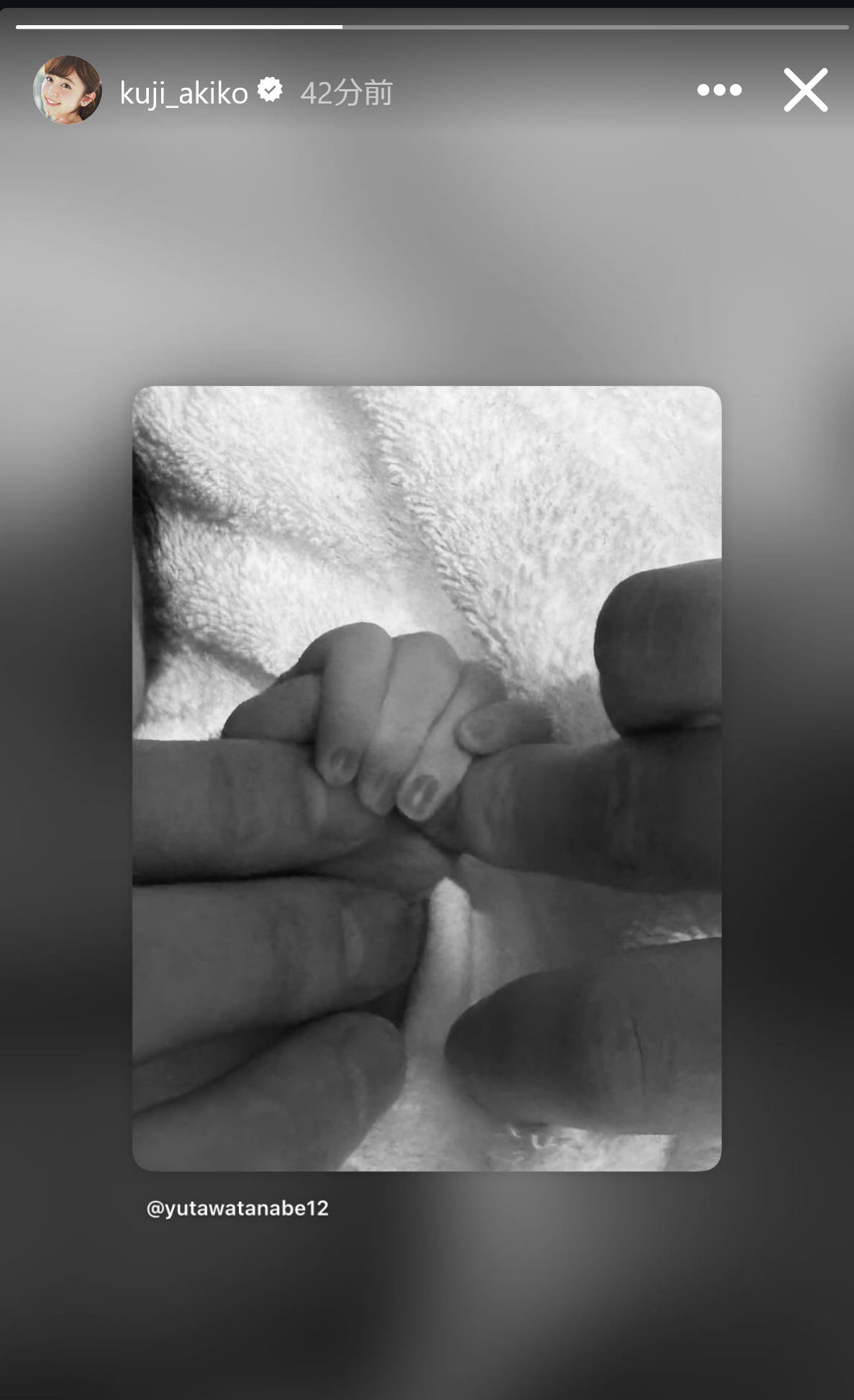 久慈暁子のストーリーズから