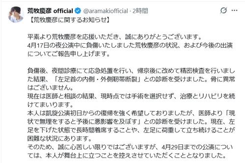 2.5次元ミュージカル協会理事俳優、舞台で左足靭帯断裂　24日から代役立てセリフ、歌のみ発声