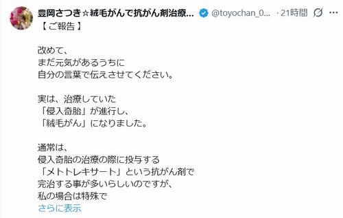 希少がん公表のセクシー女優、大学病院でも「見た事がない症例」