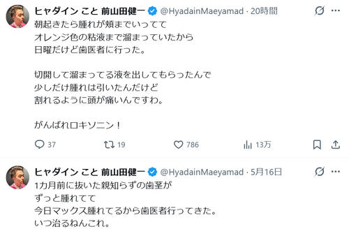 45歳ミュージシャン「腫れが頬まで」「切開して溜まってる液を…」術後１カ月でも痛み引かず