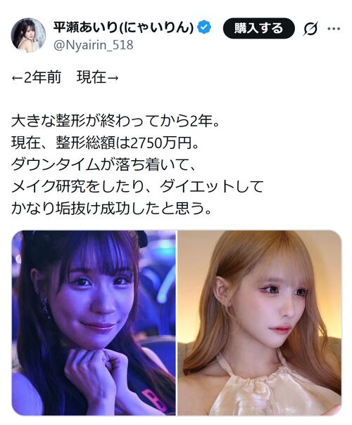 29歳モデル「大きな整形終わって２年」総額は2750万円、衝撃のビフォーアフター写真を公開