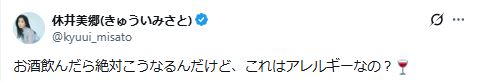 人気モデルが“美脚の異変”写真を掲載「これはアレルギーなの？」に反響「一度診察を」
