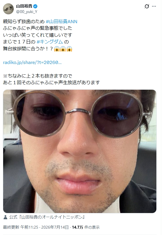 山田裕貴のXから