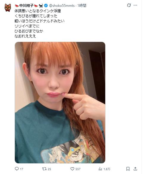中川翔子のXから