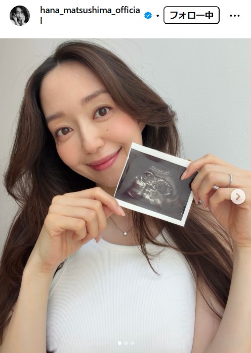 松島花のインスタグラムから