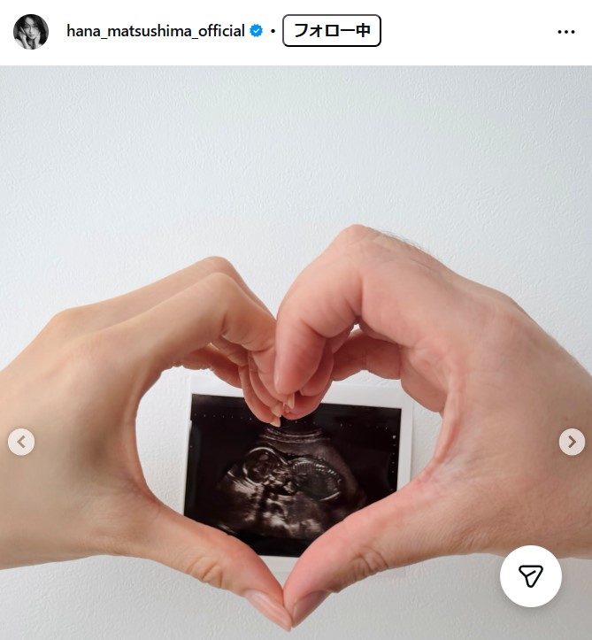 松島花のインスタグラムから