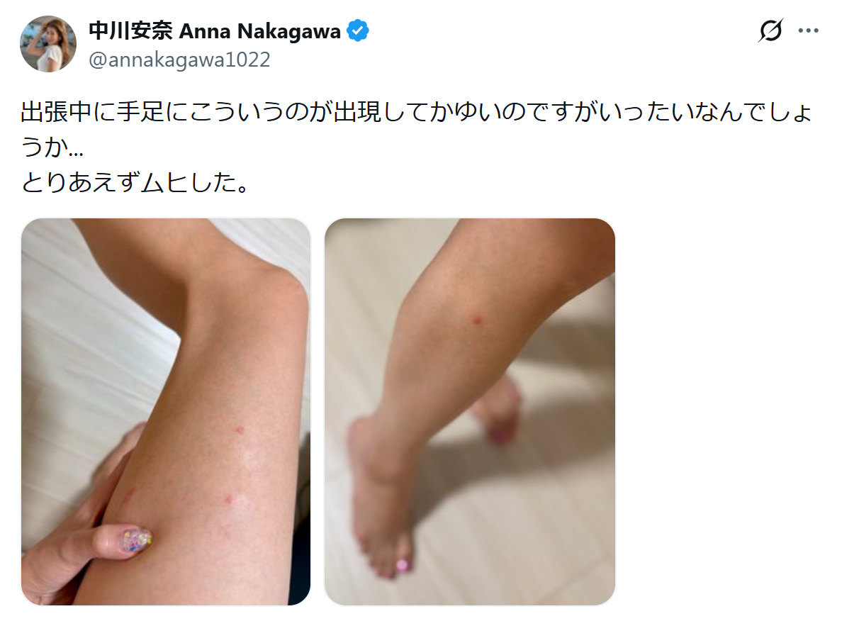 中川安奈のXから