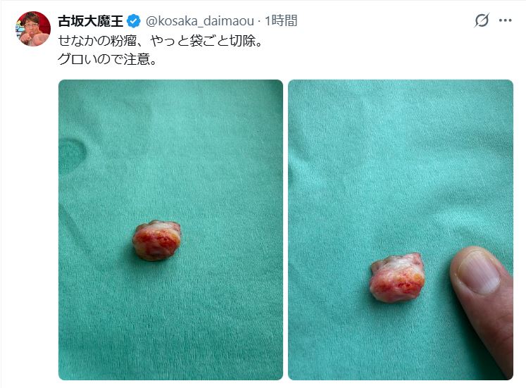 古坂大魔王のXから