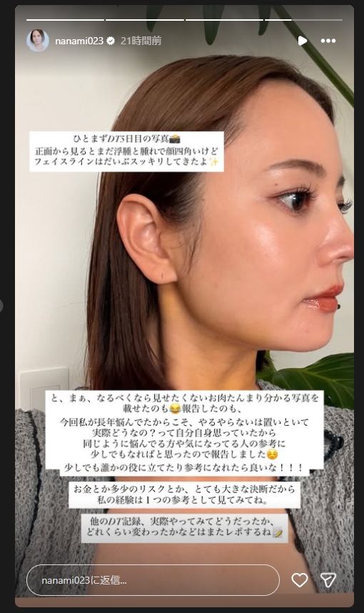 奈々未のインスタグラムから