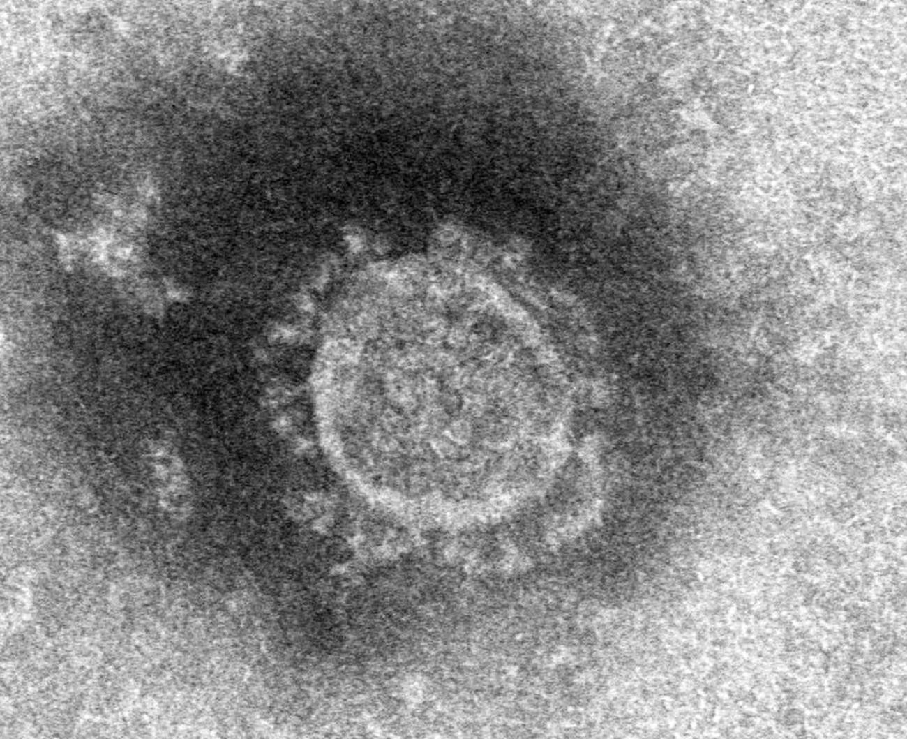 新型コロナウイルスの電子顕微鏡写真（国立感染症研究所提供＝共同）