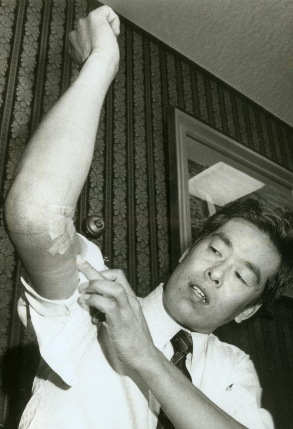 右肘の手術痕を見せるロッテ・村田兆治＝1983年9月16日
