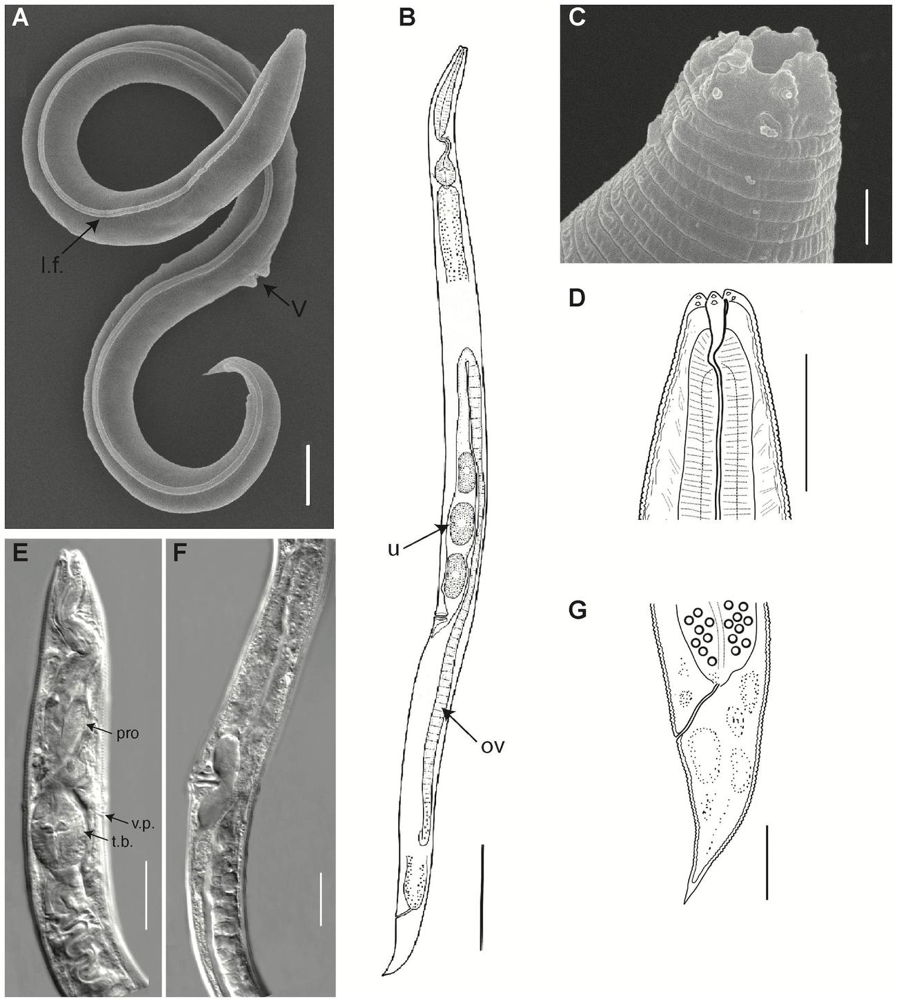 永久凍土での約4万6000年の眠りから目覚めた線虫(A.Shatilovich,V.R.Gade,et al.2023, PLOS Geneticsenetics）