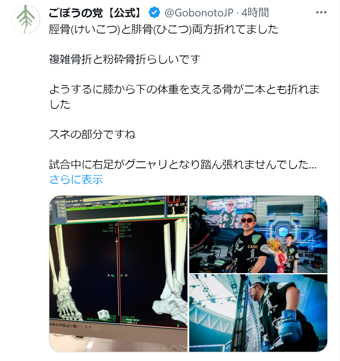 ごぼうの党の公式Xから