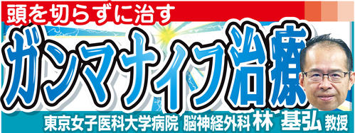 「頭を切らずに治す　ガンマナイフ治療」