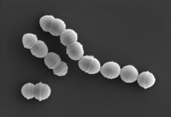 劇症型溶血性レンサ球菌感染症の主な原因となる「A群溶血性レンサ球菌」（国立感染症研究所提供）（共同）