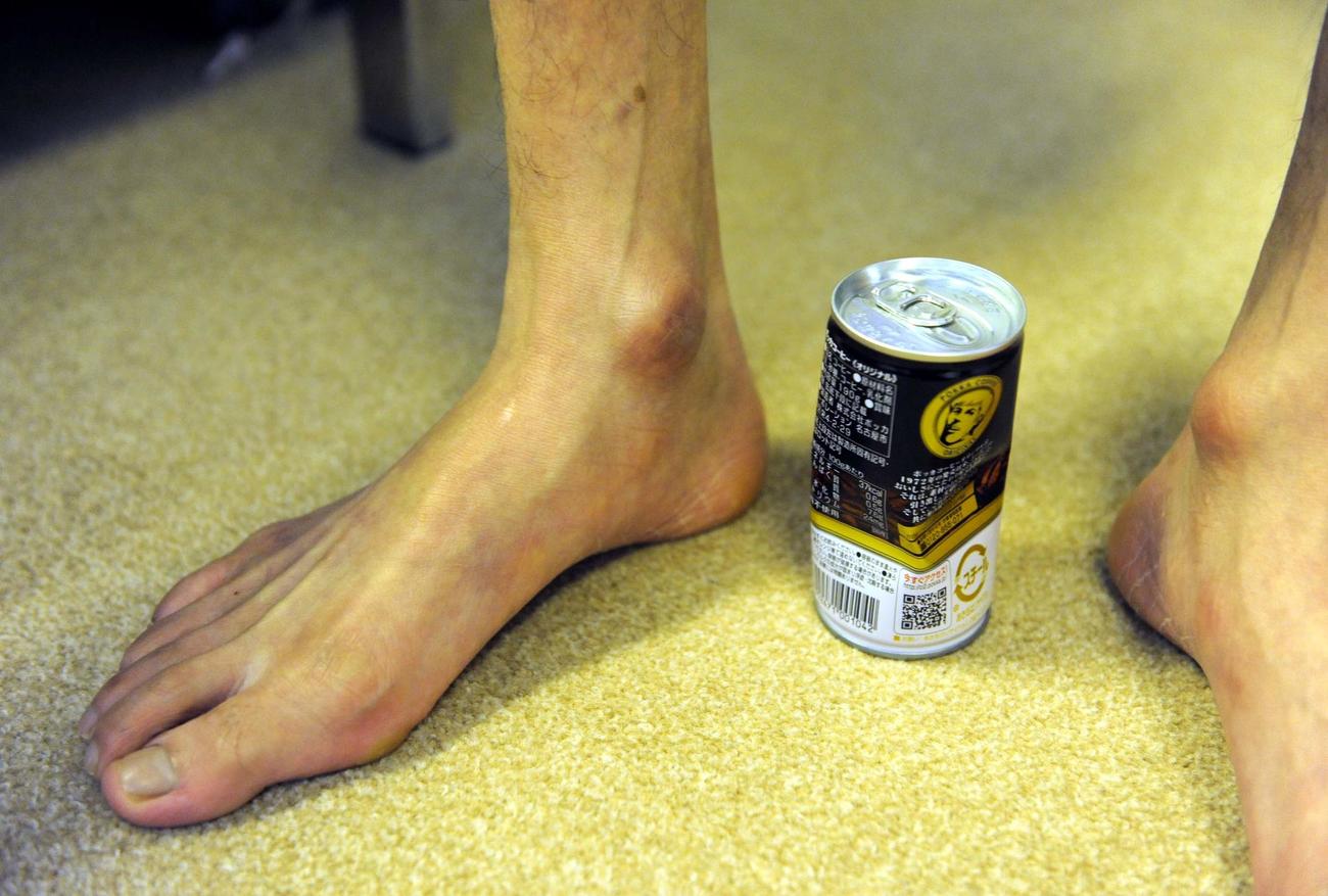 騎乗を続けて硬くなった的場文男のくるぶしはスチール缶を簡単にへこませた（09年11月撮影）