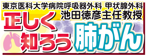 正しく知ろう肺がん