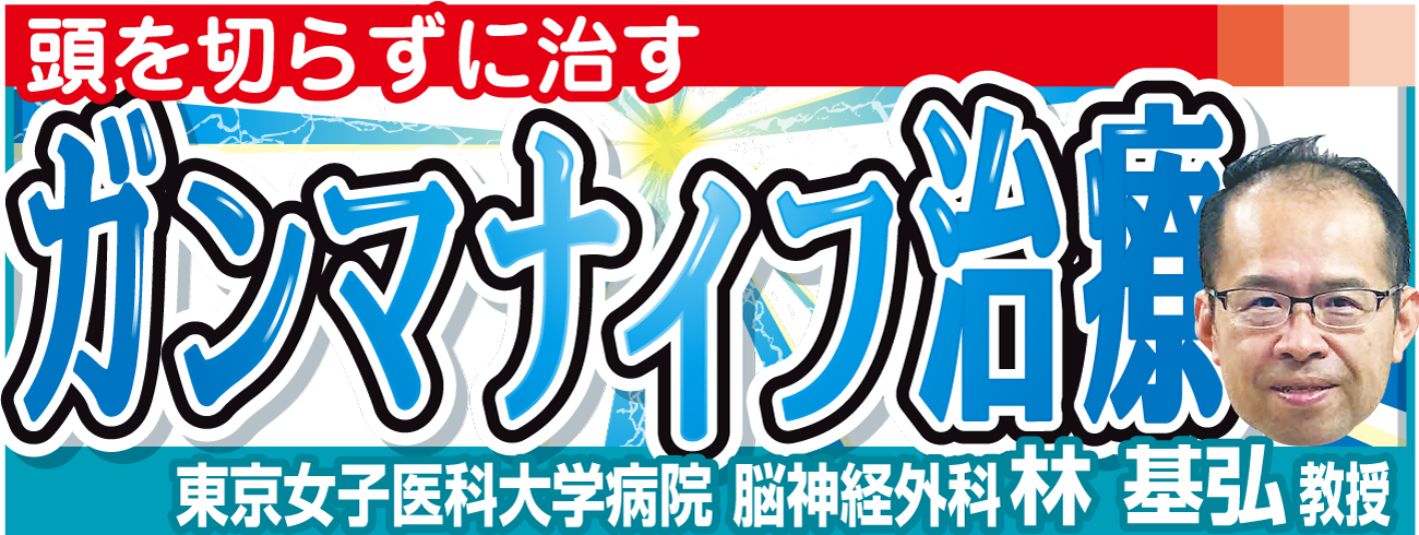 「頭を切らずに治す　ガンマナイフ治療」