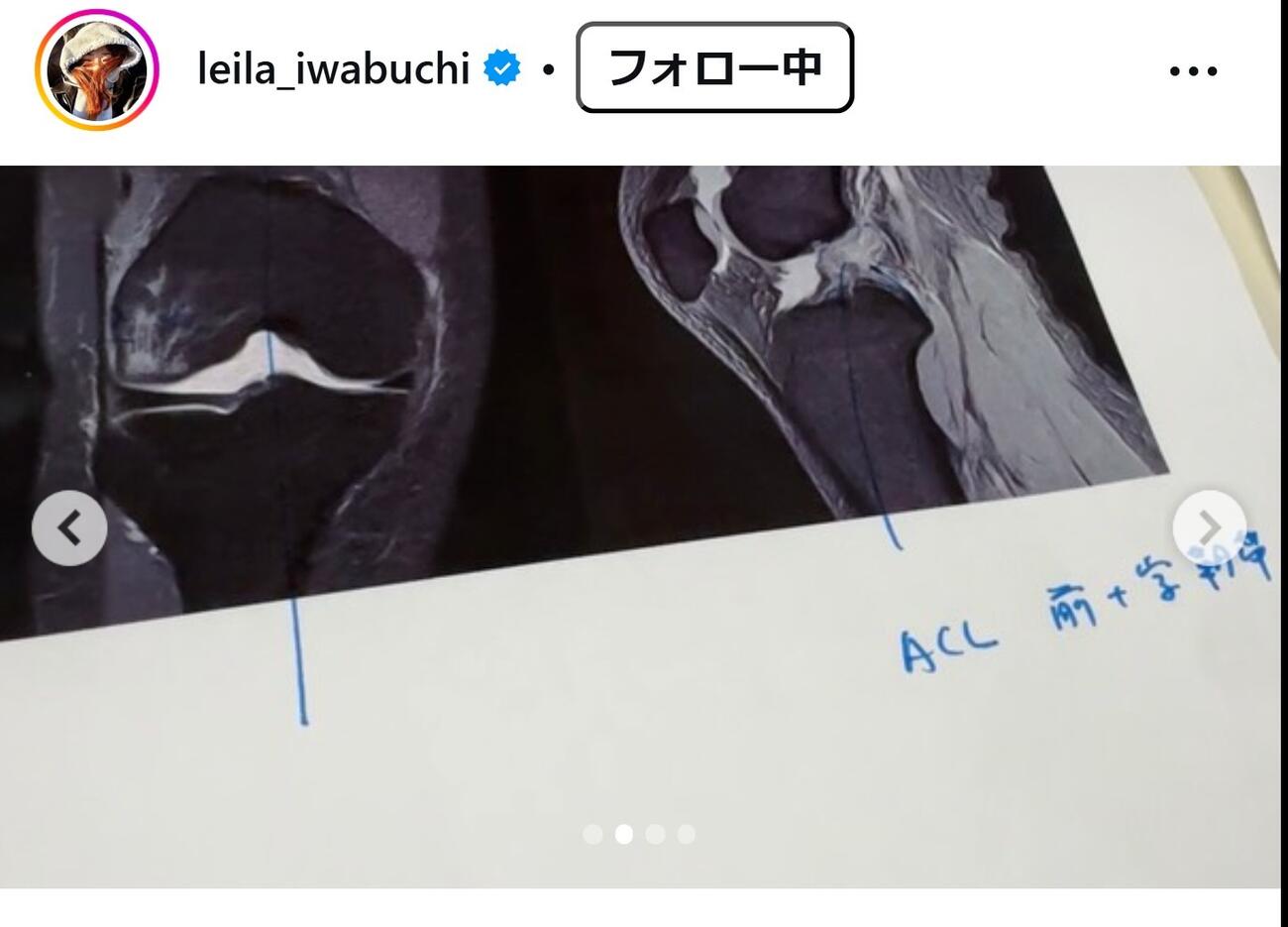 岩渕麗楽のインスタグラムから