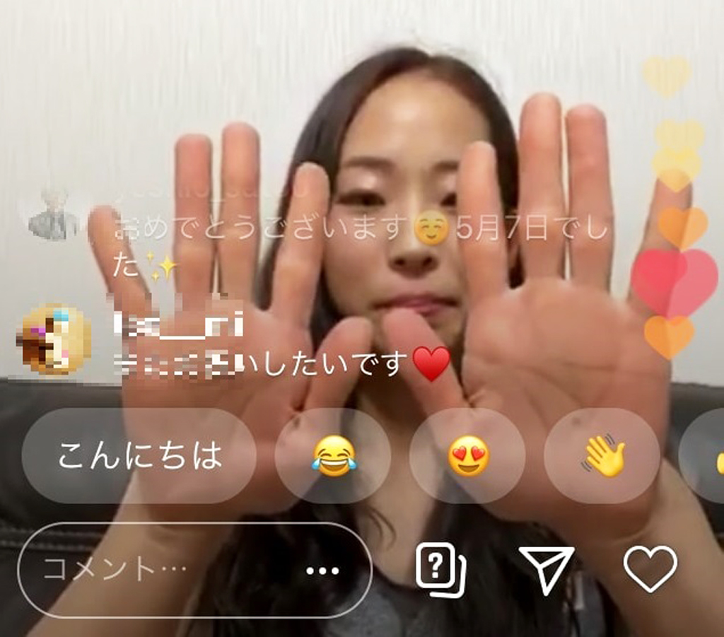 トークライブで両手を披露する野口啓代（本人インスタグラムより一部加工）